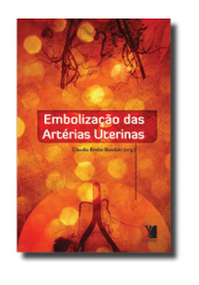 Embolização das Artérias Uterinas